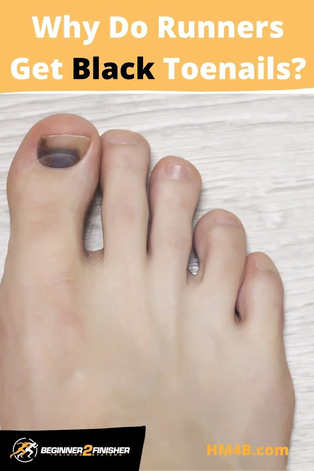 Why Do Runners Get Black Toenails? Cause, Injury, & Prevention.